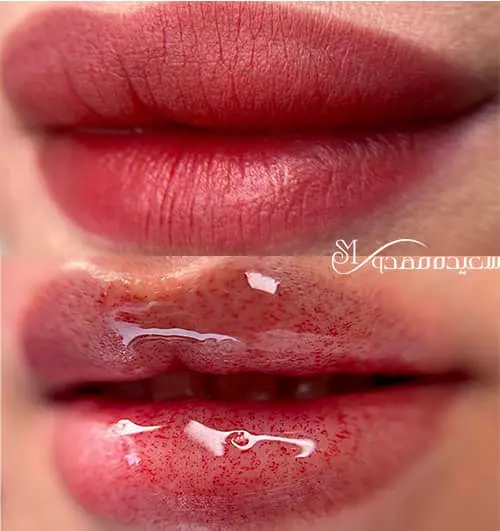 آیا آرایش دائم لب می‌تواند باعث پیری زودرس پوست شود؟