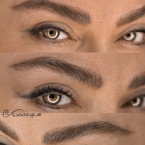 ترمیم میکروپیگمنتیشن ابرو | راهنمای جامع