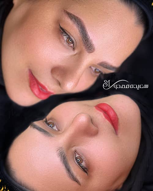 هیراستروک- ۱۰۳