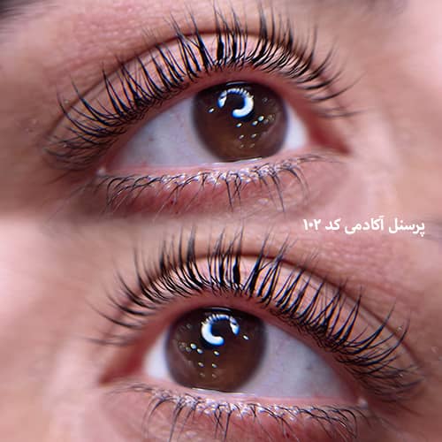 لیفت مژه