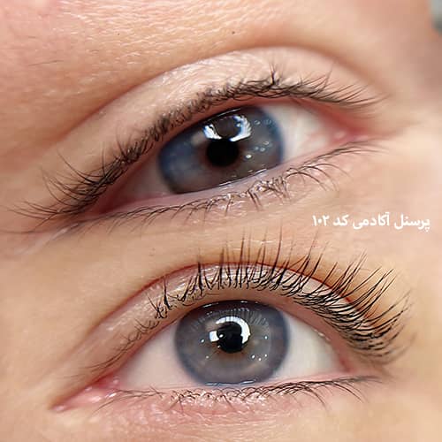 لیفت مژه