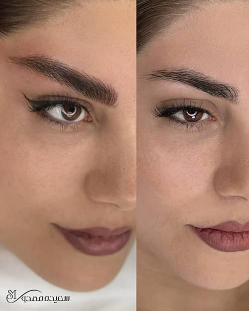 هیراستروک ابرو