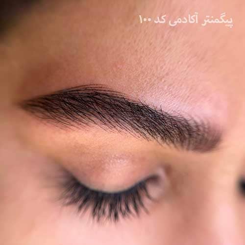 هیراستروک