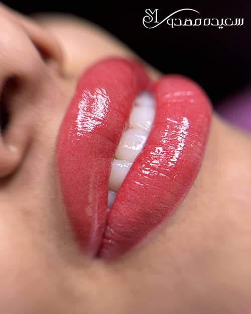 شیدینگ لب - ۱۰۰