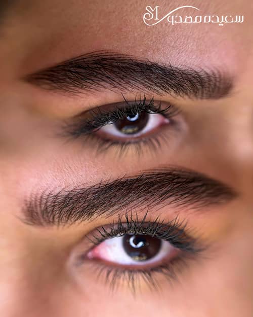 هیراستروک ابرو -۱۰۰