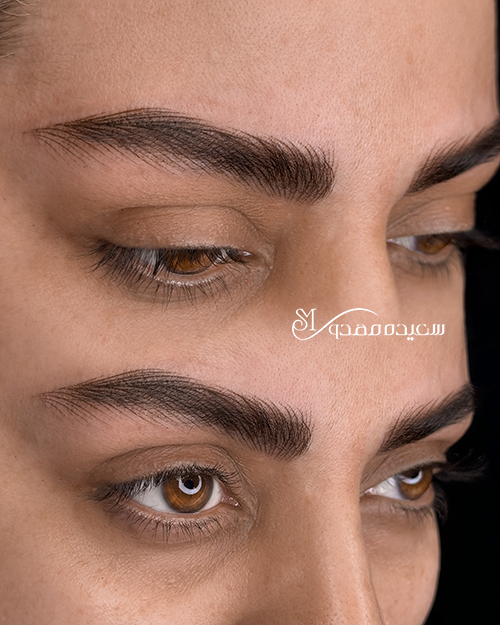 هیراستروک ابرو کد ۱۰۱